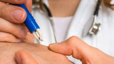 Türkiye’de kene kaynaklı yeni bakteri görüldü! Salgın uyarısı