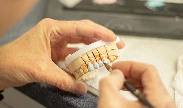 Diş protez laboratuvar hizmeti alınacak