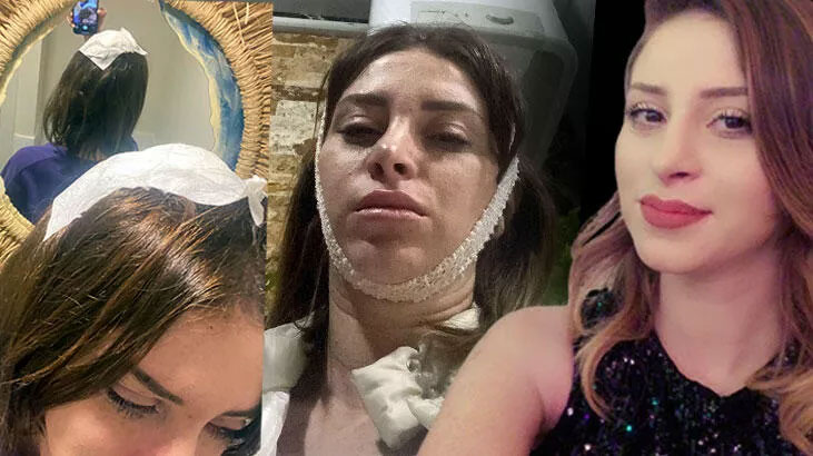 Ev basıp, eşini tabanca kabzasıyla darbeden müteahhit, teslim oldu Ev basıp, eşini tabanca kabzasıyla darbeden müteahhit, teslim oldu