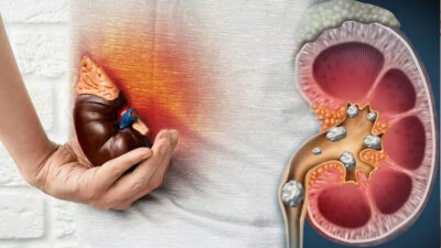 Adım adım ölüme götürüyor: Böbreklerinizin en büyük düşmanı!