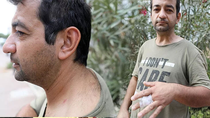 Korna çaldığı otomobilden inen 4 kişi tarafından dövüldü