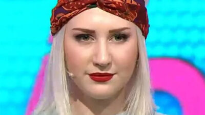 Son haliyle şoke etti! ‘Estetik değil de kafa nakli diyelim’