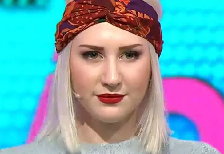 Son haliyle şoke etti! ‘Estetik değil de kafa nakli diyelim’