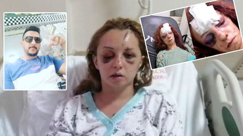 Sosyal medyada gündem olmuştu! Yoğun bakımdan çıktı, her şeyi anlattı