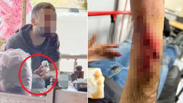 Önce Pitbull sonra sokak köpeği saldırdı; kuduz aşısı yapıldı