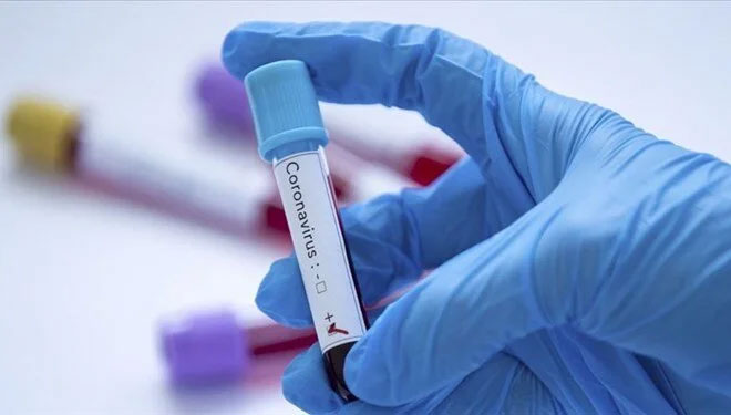 İki haftalık koronavirüs tablosu açıklandı İki haftalık koronavirüs tablosu açıklandı