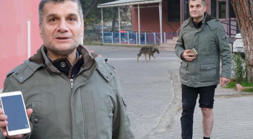 10 köpeğin saldırısına uğradı! ‘Hem psikolojim bozuk hem de yaralıyım’