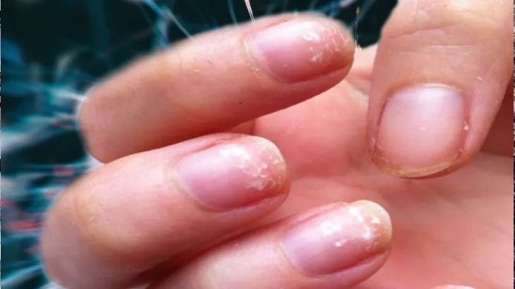 Hastalığın en erken belirtisi… Sakın önemsiz sanmayın