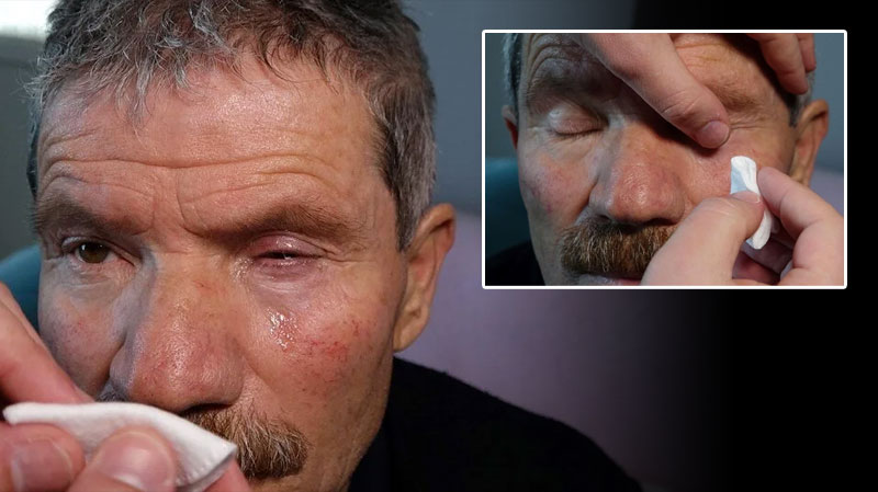‘Katarakt ameliyatı kör etti’ iddiası! Soruşturma başlatıldı