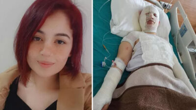 Depremzede eski eşini kaynar suyla yaktı, ‘artçı sarsıntı nedeniyle oldu’ dedi! Kan donduran sözler: ‘Dua et seni öldürmedim’