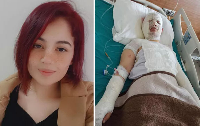 Depremzede eski eşini kaynar suyla yaktı, ‘artçı sarsıntı nedeniyle oldu’ dedi! Kan donduran sözler: ‘Dua et seni öldürmedim’