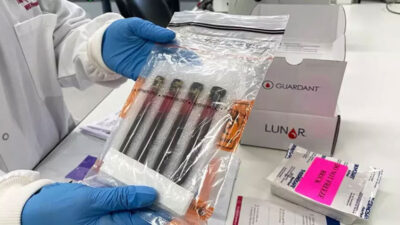 İngiltere’de denenen kan testi bağırsak kanseri hastalarını kemoterapiden kurtarabilir