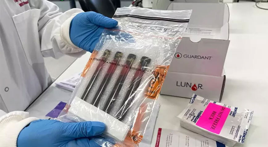 İngiltere’de denenen kan testi bağırsak kanseri hastalarını kemoterapiden kurtarabilir