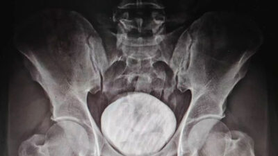 Makatında uyuşturucu tespit edilen İranlı tutuklandı!