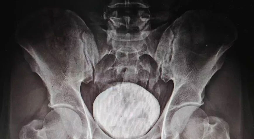 Makatında uyuşturucu tespit edilen İranlı tutuklandı!