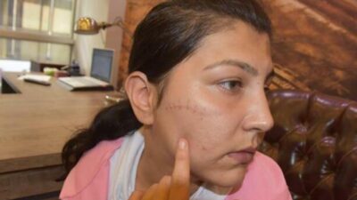 Aysel’i defalarca bıçakladı! Adli tıptan gelen rapor ortaya çıkardı