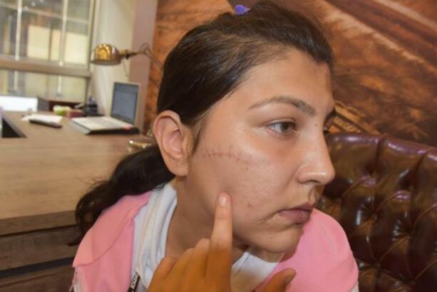 Aysel’i defalarca bıçakladı! Adli tıptan gelen rapor ortaya çıkardı