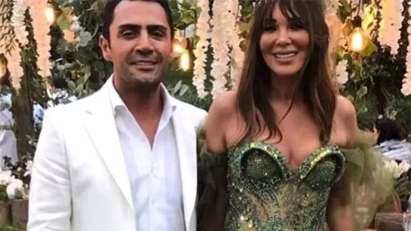 Çene estetiği yaptıran Yaşar İpek’in yeni imajı şaşırttı!