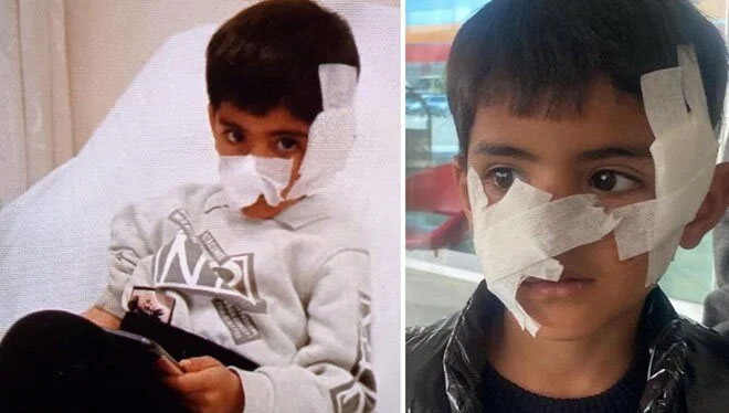 Köpeklerin saldırdığı çocuğa 40 dikiş atıldı