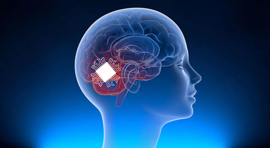 Elon Musk’ın beyin çipi şirketi Neuralink’e insanlı deney için onay