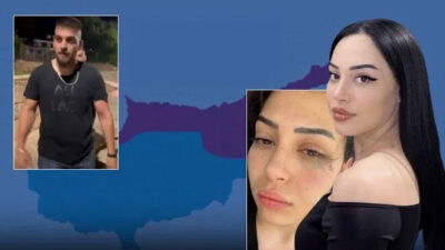 Güney Kıbrıs’ta Türk kızına saldırı: 2 Rum saldırgan gözaltında
