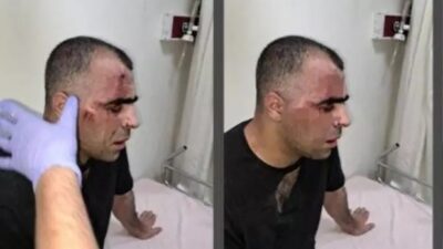 Belediye çalışanı gazeteciyi darbetti! Valilik açıklama yaptı