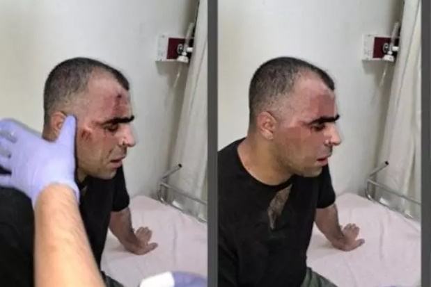 Belediye çalışanı gazeteciyi darbetti! Valilik açıklama yaptı