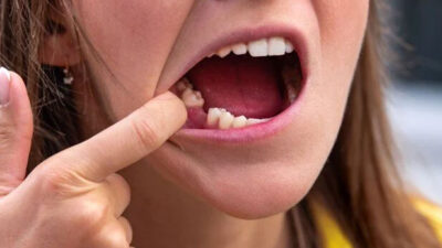 Japonya’da ilaç geliştiriliyor: Dişler yeniden çıkarılabilir