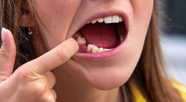 Japonya’da ilaç geliştiriliyor: Dişler yeniden çıkarılabilir