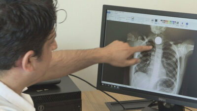 Aman dikkat! Çocuklardan uzak tutun! Yutarlarsa tehlike büyük