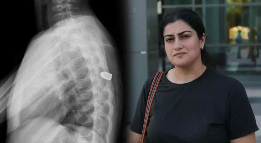 Oyun oynarken bir anda yere yığıldı! Böcek ısırığı sandılar hemen ameliyata alındı Oyun oynarken bir anda yere yığıldı! Böcek ısırığı sandılar hemen ameliyata alındı