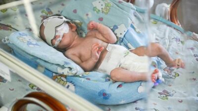 Hamza bebeğin görebilmesi için başlayan zamanla yarış mutlu bitti