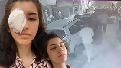 Maganda kurşunu 16 yaşındaki kızı kör etti