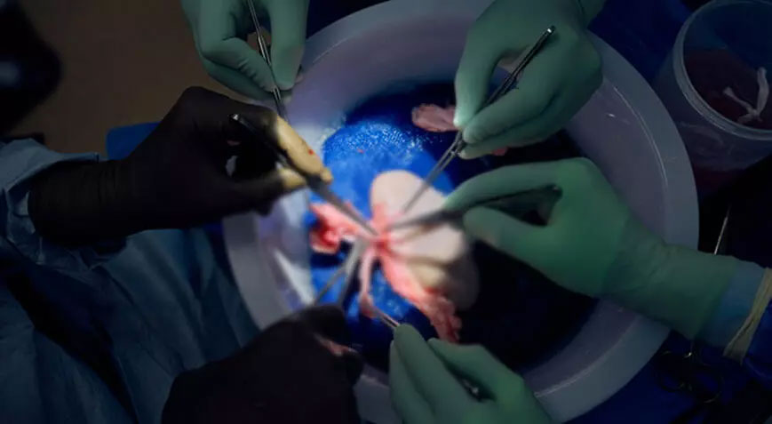 Ölen kişiye domuz böbreği nakli yapıldı! Günlerce çalışmayı başardı Ölen kişiye domuz böbreği nakli yapıldı! Günlerce çalışmayı başardı