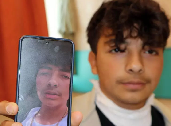 Boynundaki kolyeye yıldırım düştü, ölümden döndü