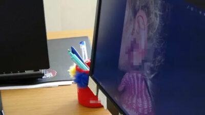 3 yaşındaki çocuğun kulağından çıkartılanlar şoke etti: Tam 23 adet!