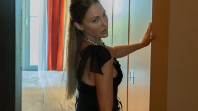 Yüzündeki şişlik dikkat çekti! Yorum yağdı…