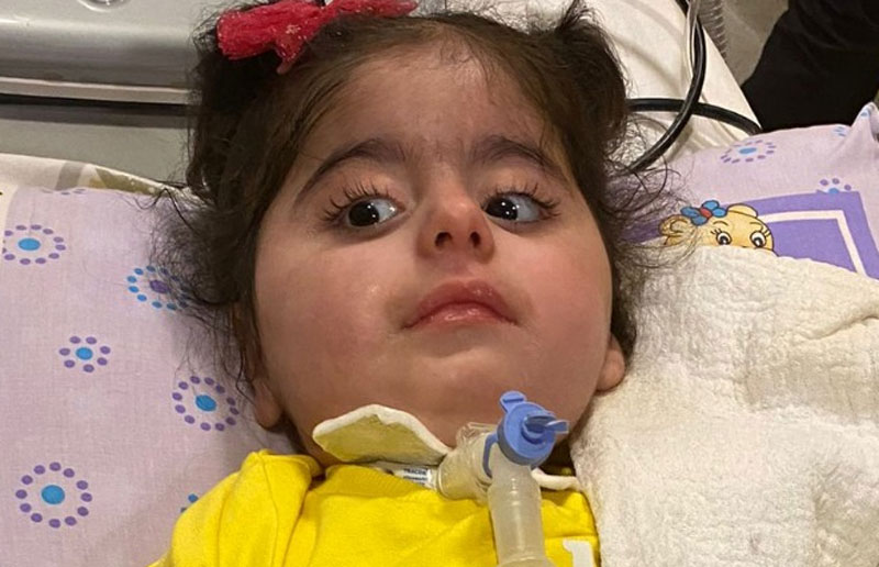 Bursa’da SMA’lı Havvanur destek bekliyor