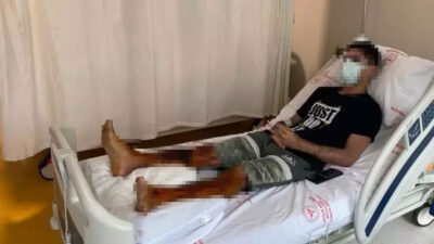 Lavabo açıcı bomba gibi patladı! ‘Acı çeke çeke hastaneye gittim’