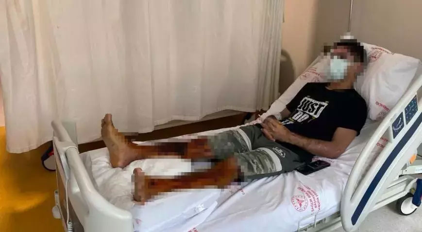 Lavabo açıcı bomba gibi patladı! ‘Acı çeke çeke hastaneye gittim’