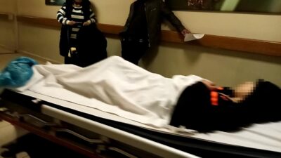 Bursa’da bahçede bulduğu tineri ateşe veren çocuk yaralandı