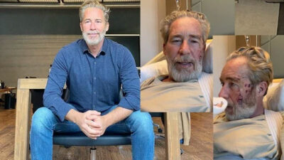 Oyuncu Sinan Albayrak sette kaza geçirdi