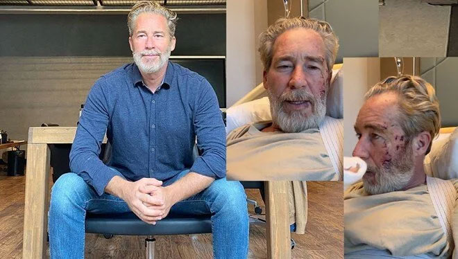 Oyuncu Sinan Albayrak sette kaza geçirdi