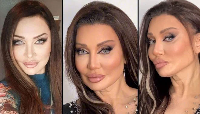 Umut Akyürek’in son hali takipçilerini ikiye böldü