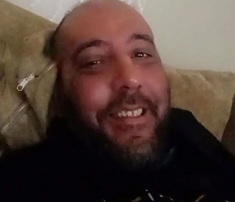 Covid-19’dan sonra milyonda 2 görülen hastalığa yakalandı: Yüzü tanınmaz hale geldi