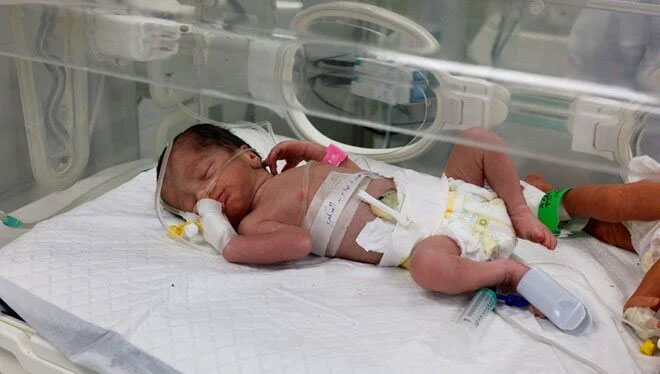 Gazze’nin mucize bebeği yaşam mücadelesini kaybetti