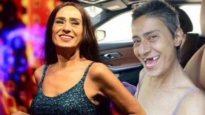 Yıldız Tilbe’nin dişsiz fotoğrafları çok konuşuldu!