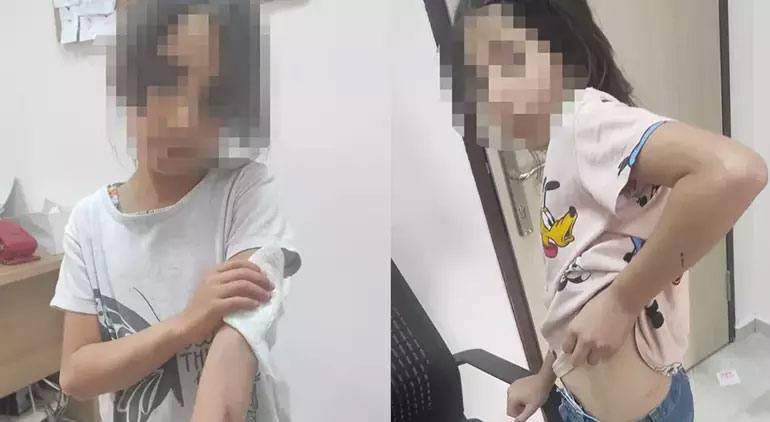 Kuzenini kuma getirdi! Evde kocası evi terk edince kardeşi dövdü