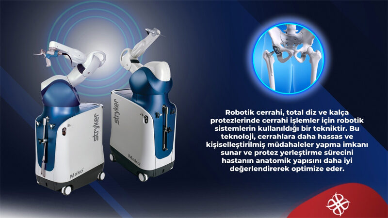 Bursa’da Hayat Hastanesi’nde robotik cerrahi dönemi Hayat Hastanesi Ortopedi ve Travmatoloji Uzmanı Doç. Dr. Abdullah Küçükalp,