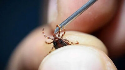 Sağlık Bakanlığı’ndan kene açıklaması